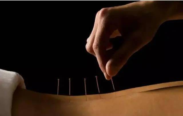 平衡針灸最新視頻，現(xiàn)代應用探索針灸藝術的新境界