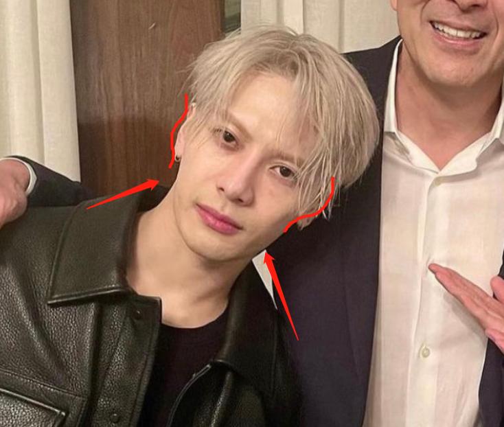 深度解析明星整容后遺癥，觀點與影響探討