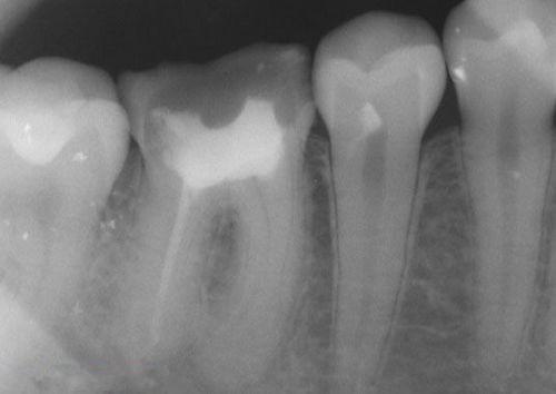 中國再生牙齒研究新進展，重塑微笑，科技引領牙齒再生新篇章