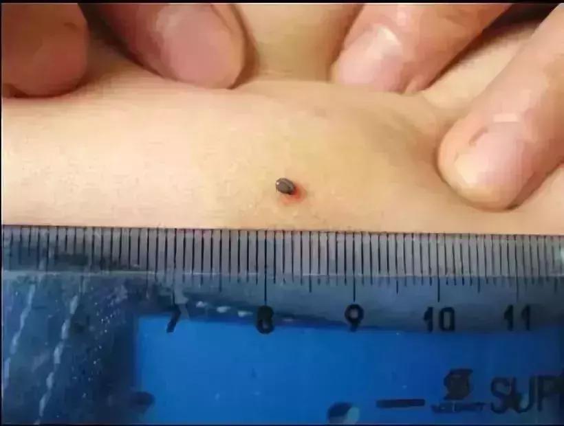 小明快樂疫情日志，最新疫情發(fā)布與日常觀察