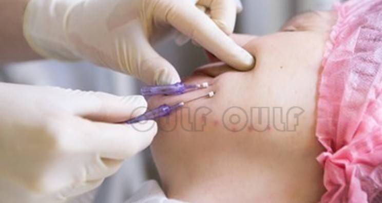 線雕最新手法，背景、發(fā)展、時代地位及展望